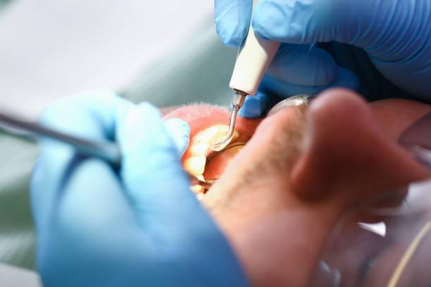 Best Weekend Emergency Dentist in Spiro, OK