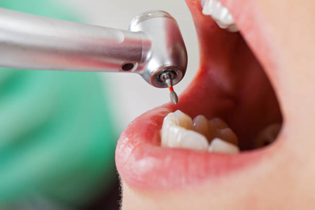 Best After-Hours Dental Trauma Care in Spiro, OK